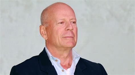 what is the diagnosis for bruce willis